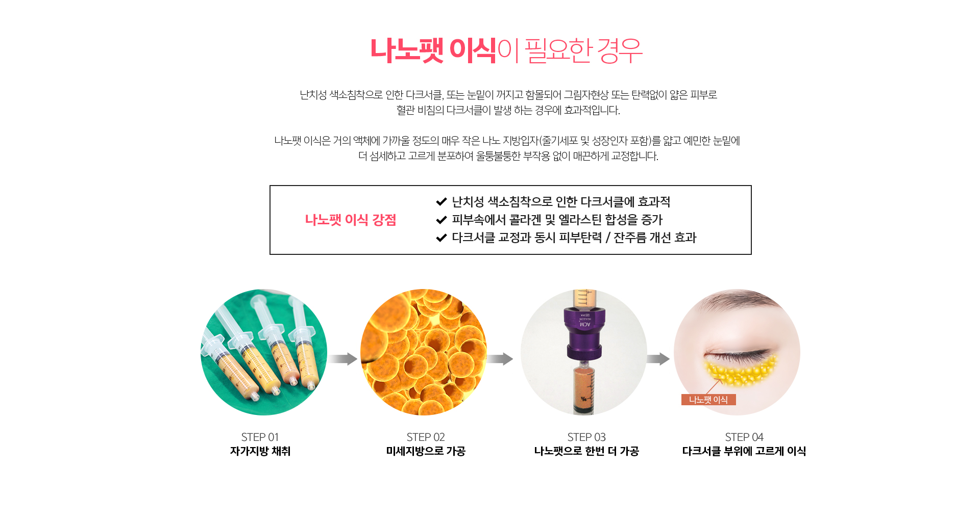 나노팻 이식 – 미세 지방을 눈밑에 이식해 잔주름과 눈물고랑을 자연스럽게 채우는 시술 안내