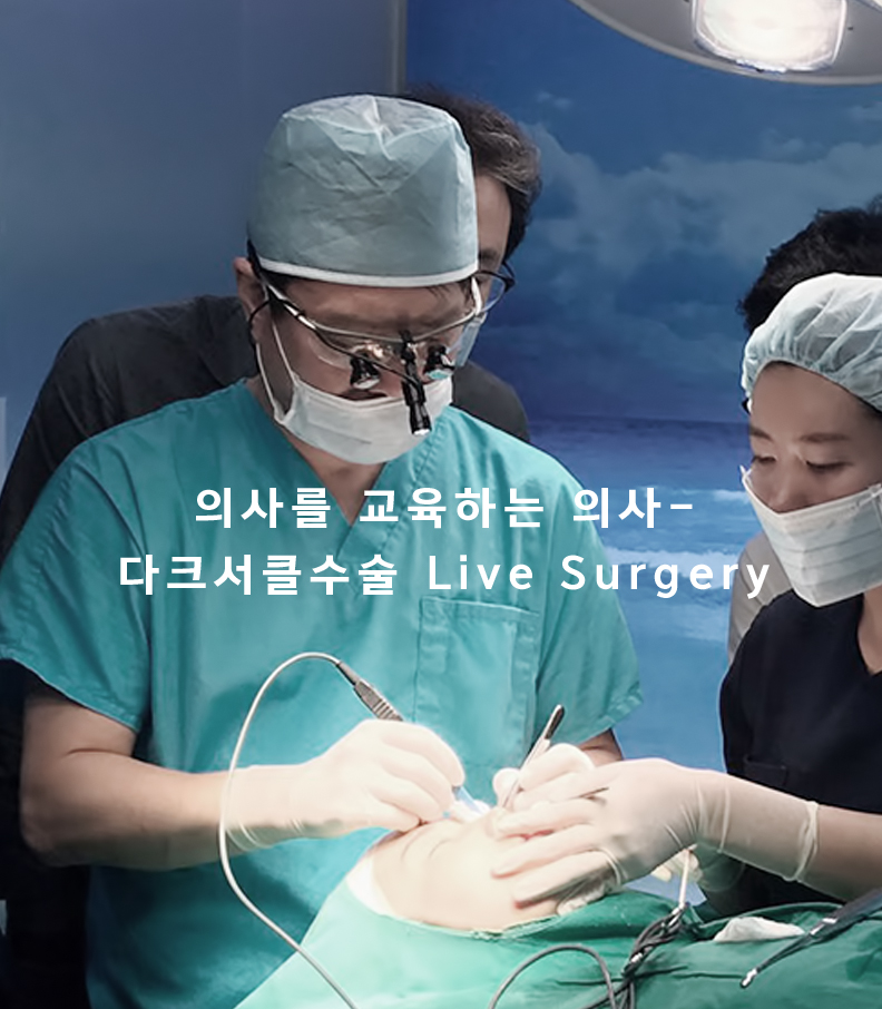 눈밑지방재배치 전후 비교 사진 2 – 눈밑 볼륨 재배치 결과