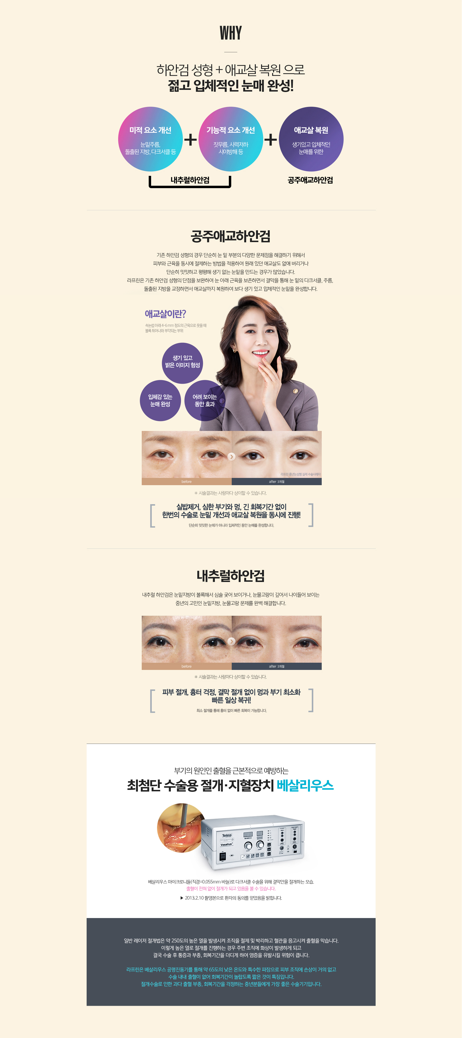 라프린 중안면거상 수술 방법 – SMAS 근막층을 끌어올려 팔자주름과 볼 처짐을 근본부터 개선하는 수술 과정 안내