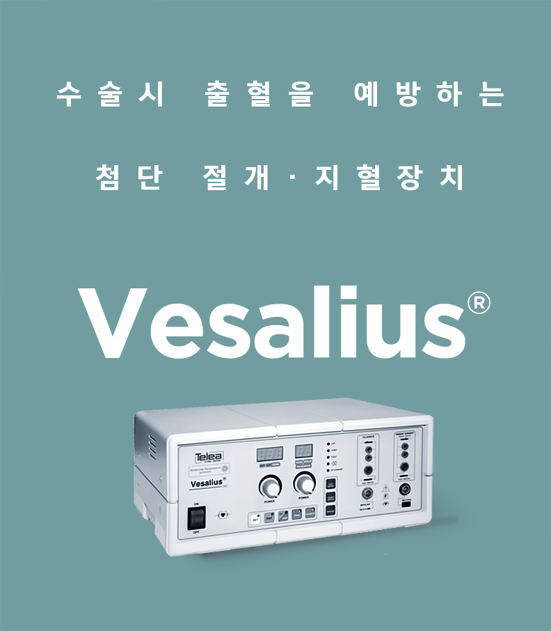 중안면거상 전후 비교 사진 2 – 눈밑 처짐·앞광대 볼륨 회복 효과
