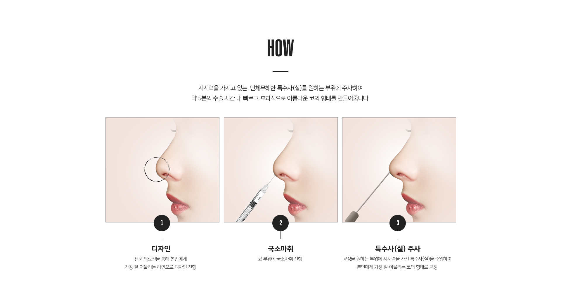 공주코 시술 후 회복과정 - 붓기, 회복기간, 일상복귀 안내 및 유지기간 정보
