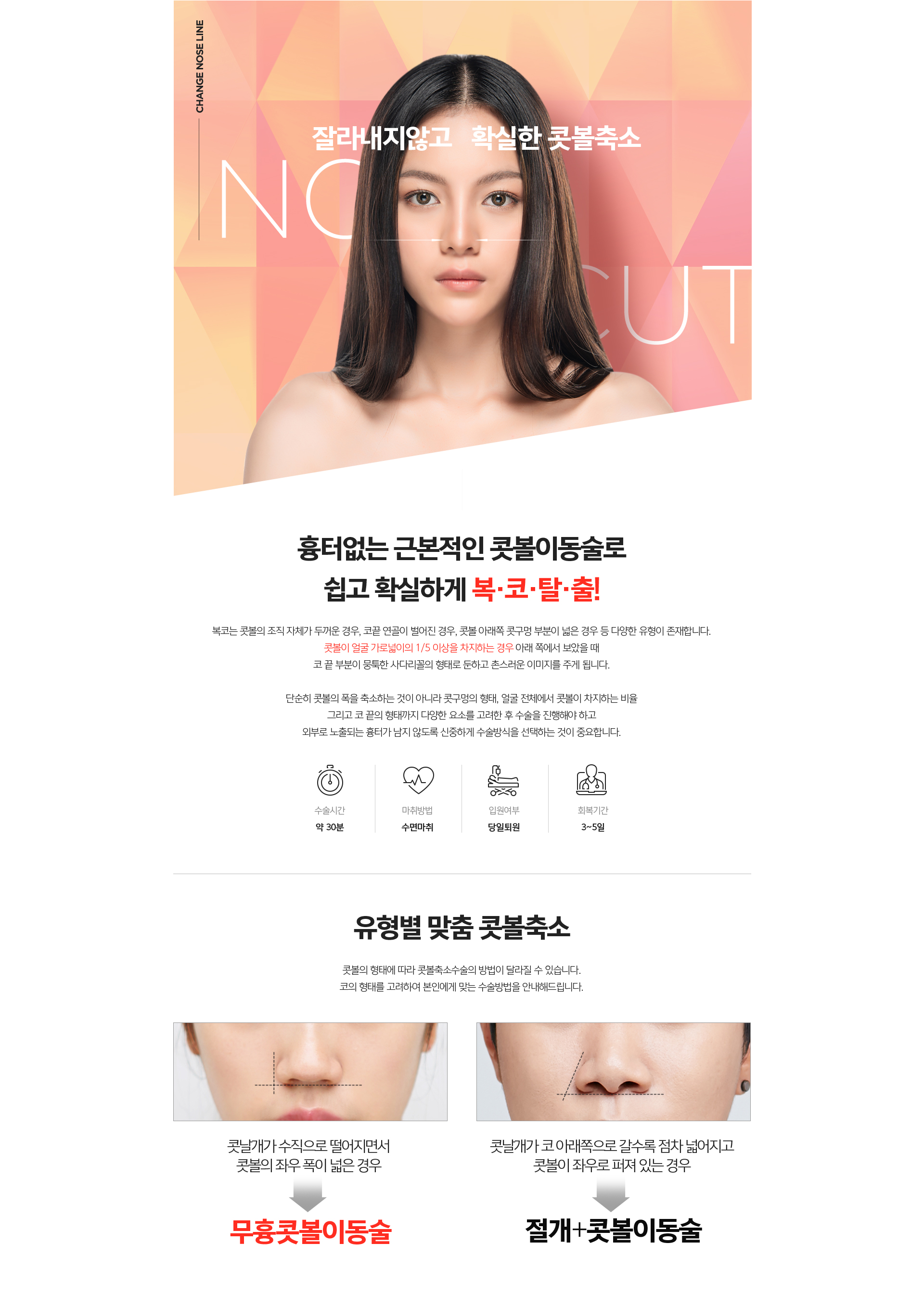무흉콧볼이동술 소개 - 콧볼 안쪽 절개로 외부 흉터 없이 콧볼 크기와 위치를 근본적으로 교정하는 수술 안내