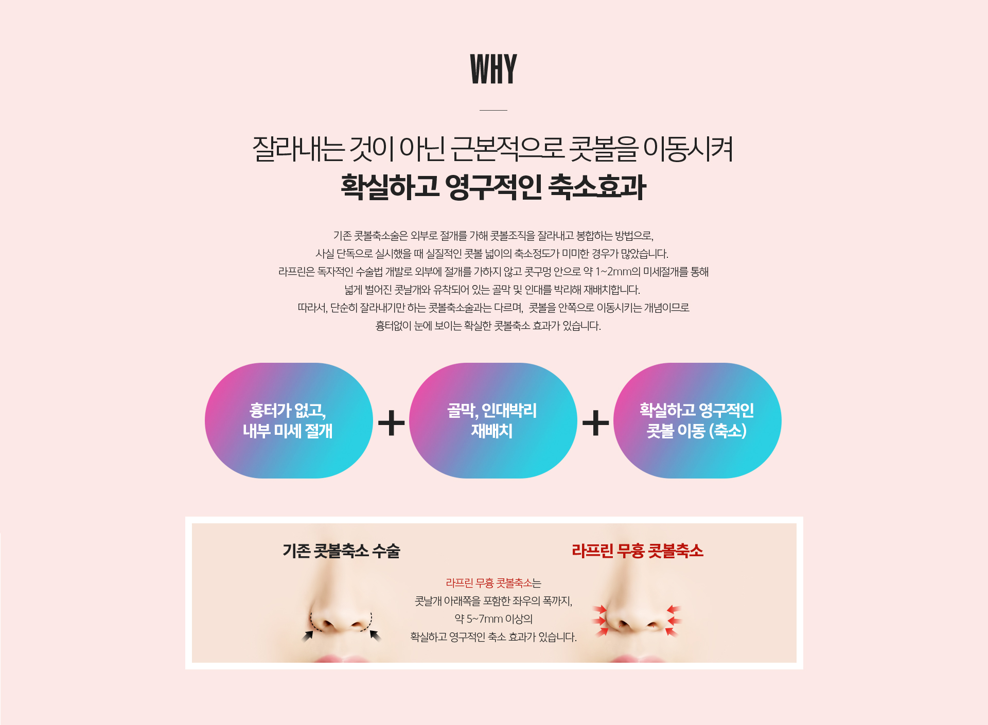 무흉콧볼이동술 수술 방법 - 콧구멍 안쪽 최소 절개, 콧볼 축소와 위치 재배치 과정 설명