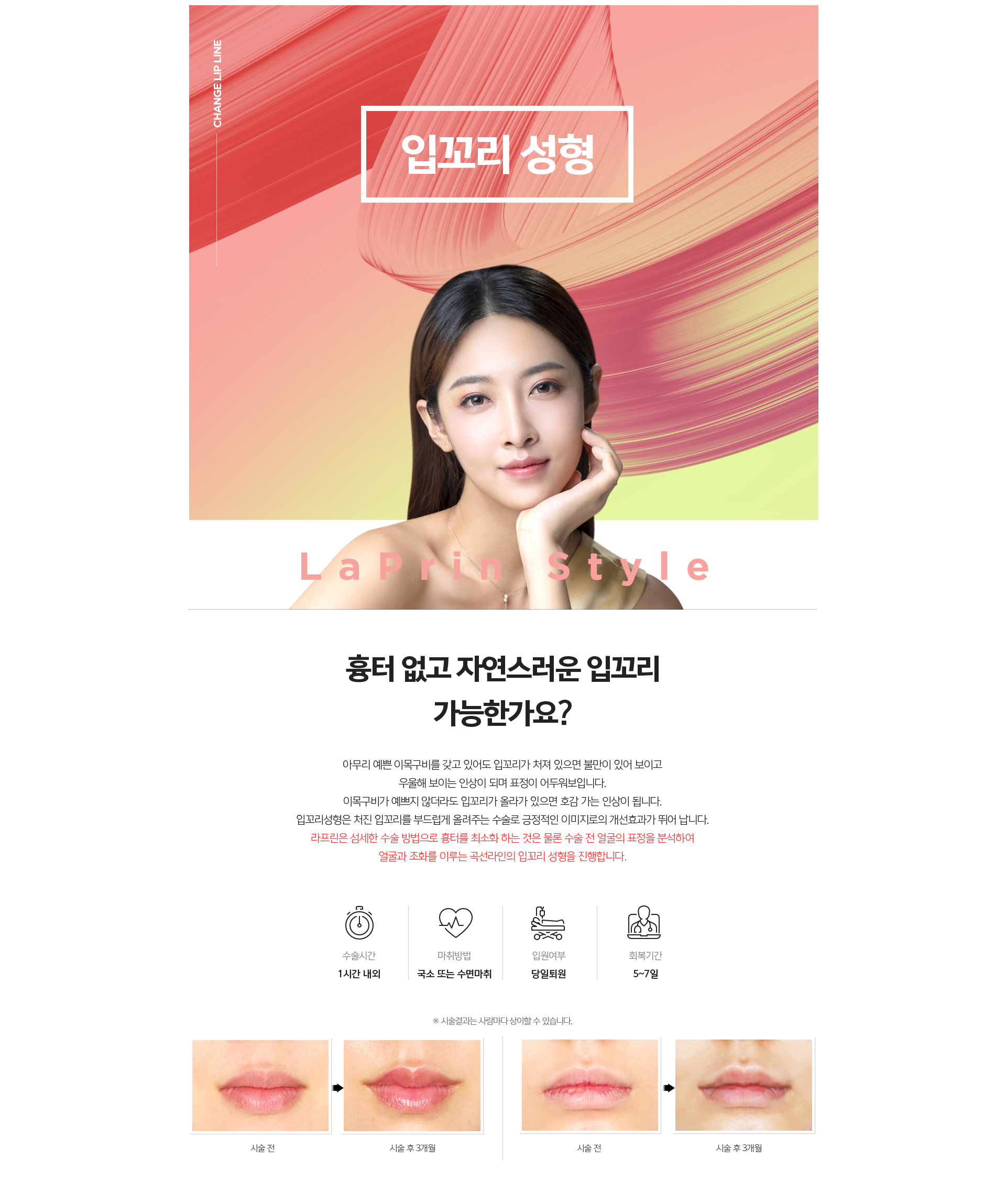 입꼬리성형 소개 - 근육·지방·뼈 구조 분석 후 내림근 약화와 올림근 강화를 통해 처진 입꼬리를 자연스럽게 올리는 수술 안내