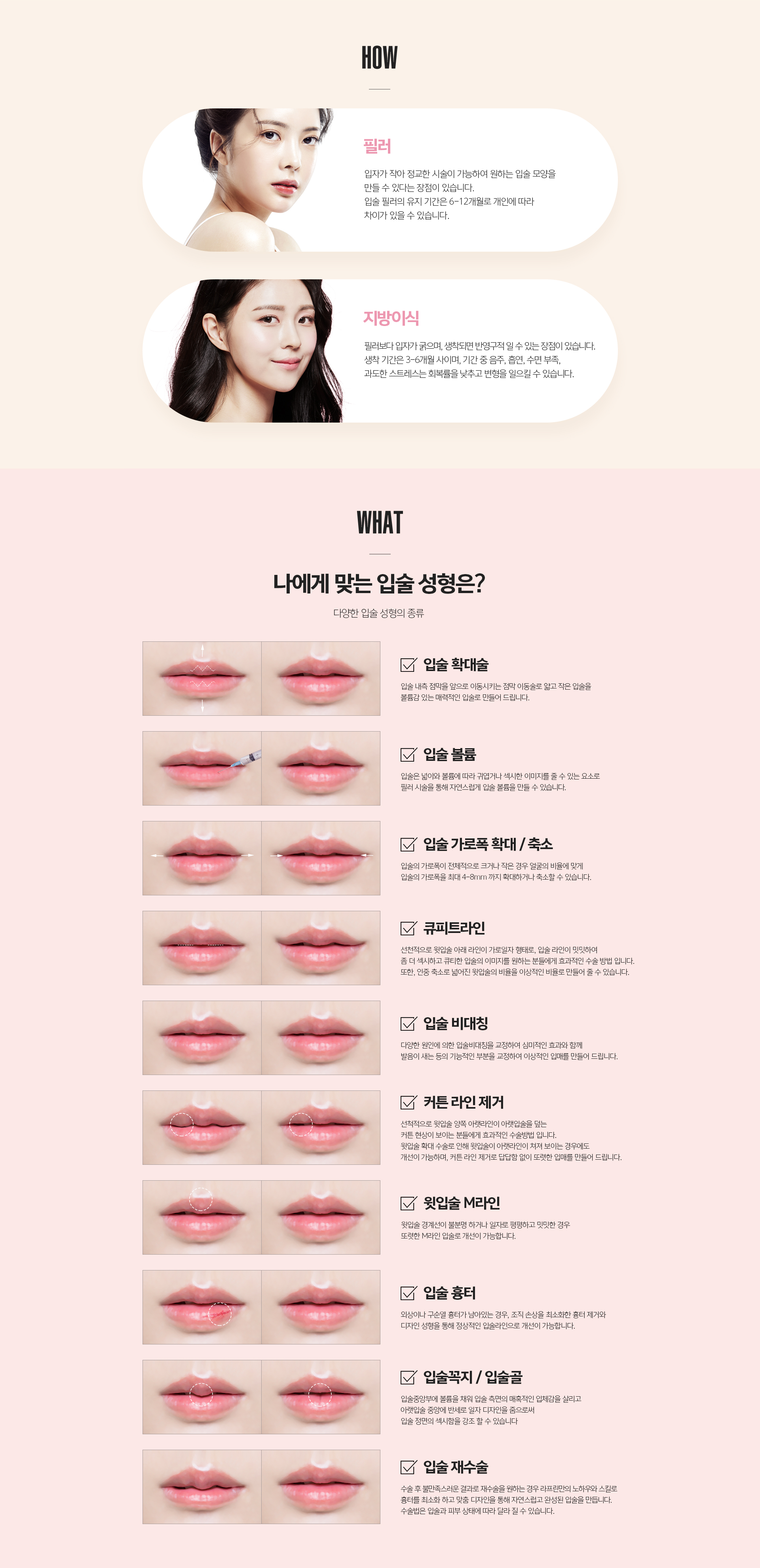 입술필러 디자인 유형 - 큐피트라인, 커튼라인, M라인, 입술꼭지, 입술골 등 11가지 세부 디자인과 입술확대술 안내