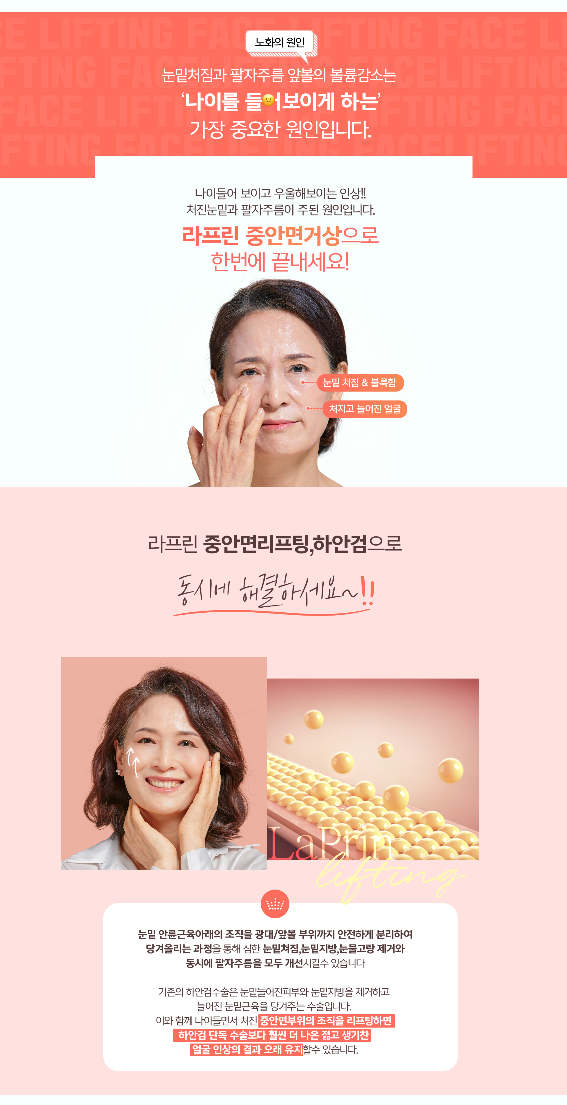 라프린 하안검성형 수술 방법 – 결막을 통해 접근해 눈 아래 근육을 보존하면서 돌출 지방을 교정하고 소실된 애교살까지 복원하는 내추럴하안검 과정 안내