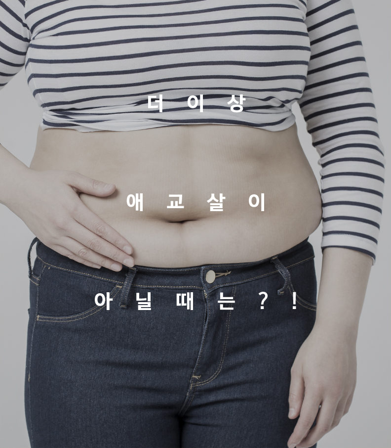 허리 지방흡입 전후 비교 사례 3